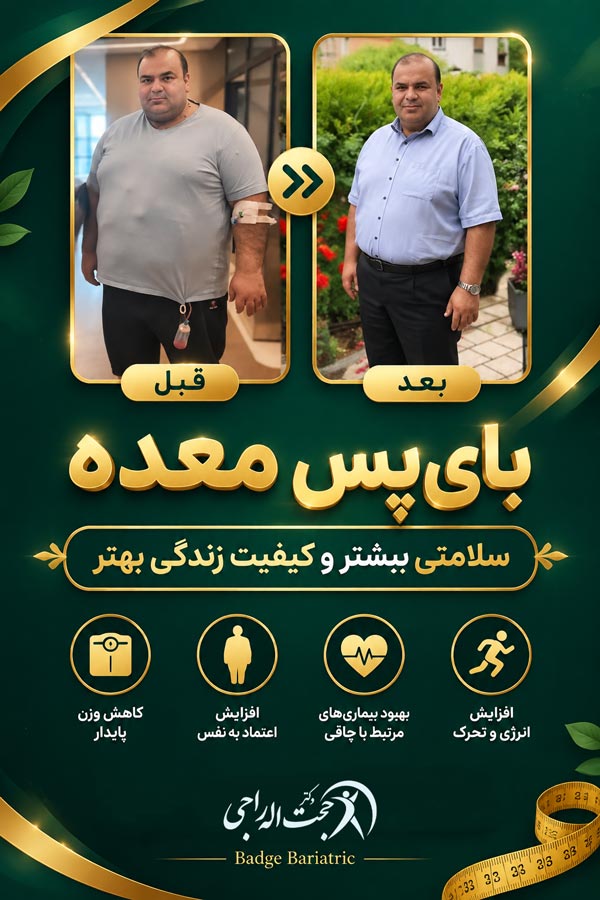قبل و بعد از جراحی بای پس معده
