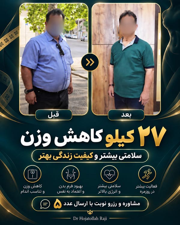نتیجه و تغییرات لاغری قبل و بعد از جراحی اسلیو معده