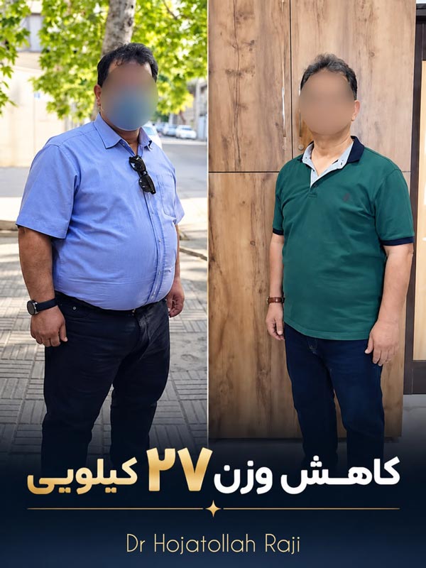 قبل و بعد از جراحی چاقی