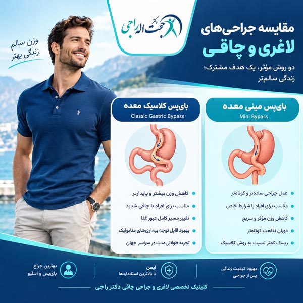 انواع بای‌پس معده