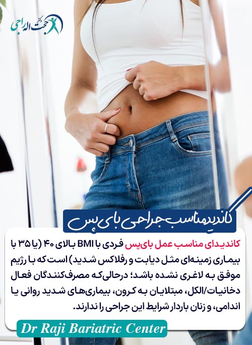 کاندید مناسب جراحی بای‌پس معده