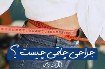 جراحی چاقی چیست ؟