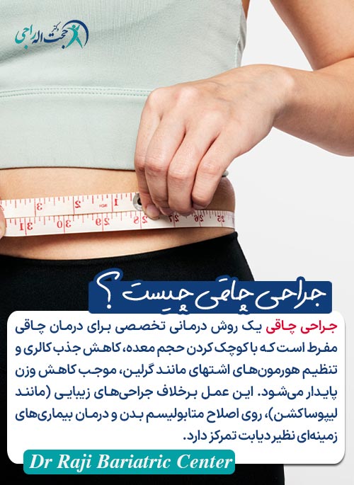جراحی چاقی چیست ؟