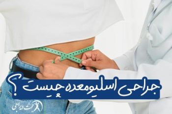 جراحی اسلیو معده