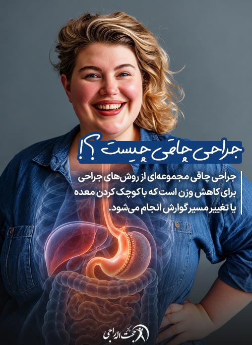 جراحی چاقی چیست و چگونه به لاغری کمک میکند؟