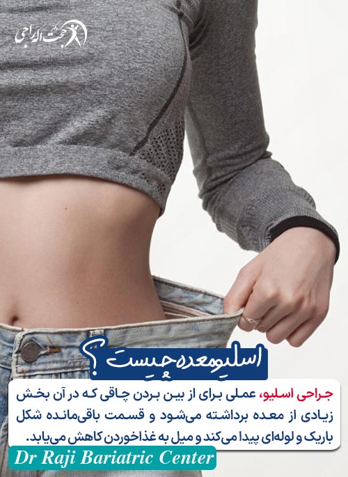 اسلیو معده چیست و چگونه انجام می شود؟
