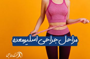 مراحل عمل اسلیو معده