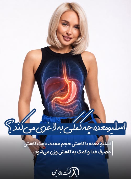 اسلیو معده چگونه به کاهش وزن کمک میکند؟