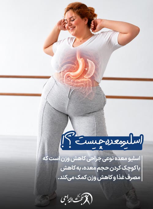 اسلیو معده چیست و چه کسانی میتوانند انجام دهند؟